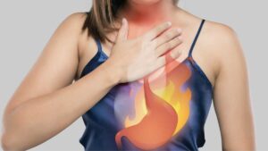 Medical illustration of stomach showing acid reflux and ulcer irritation, highlighting how stress increases stomach acid and worsens digestive problems.